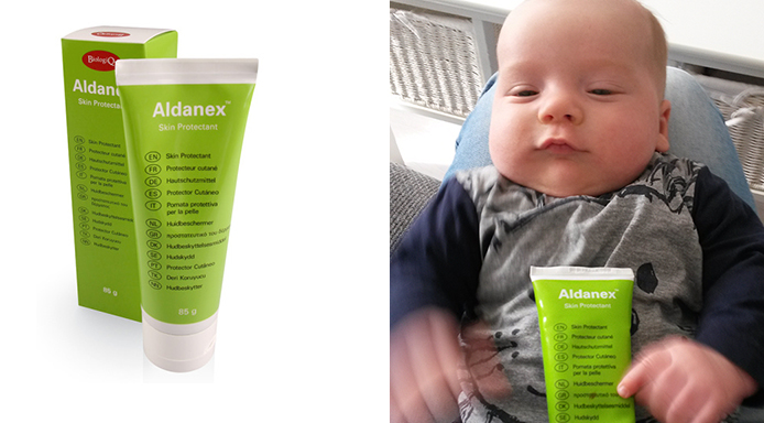 Blije babybilletjes met Aldanex