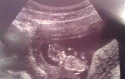 Vier kinderen, dan ging zwanger worden zeker makkelijk?