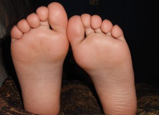 Comfortabel bewegen met hielspoor: zo wordt elke stap weer draaglijker hielspoor